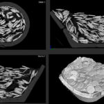 03-4_Computertomographie